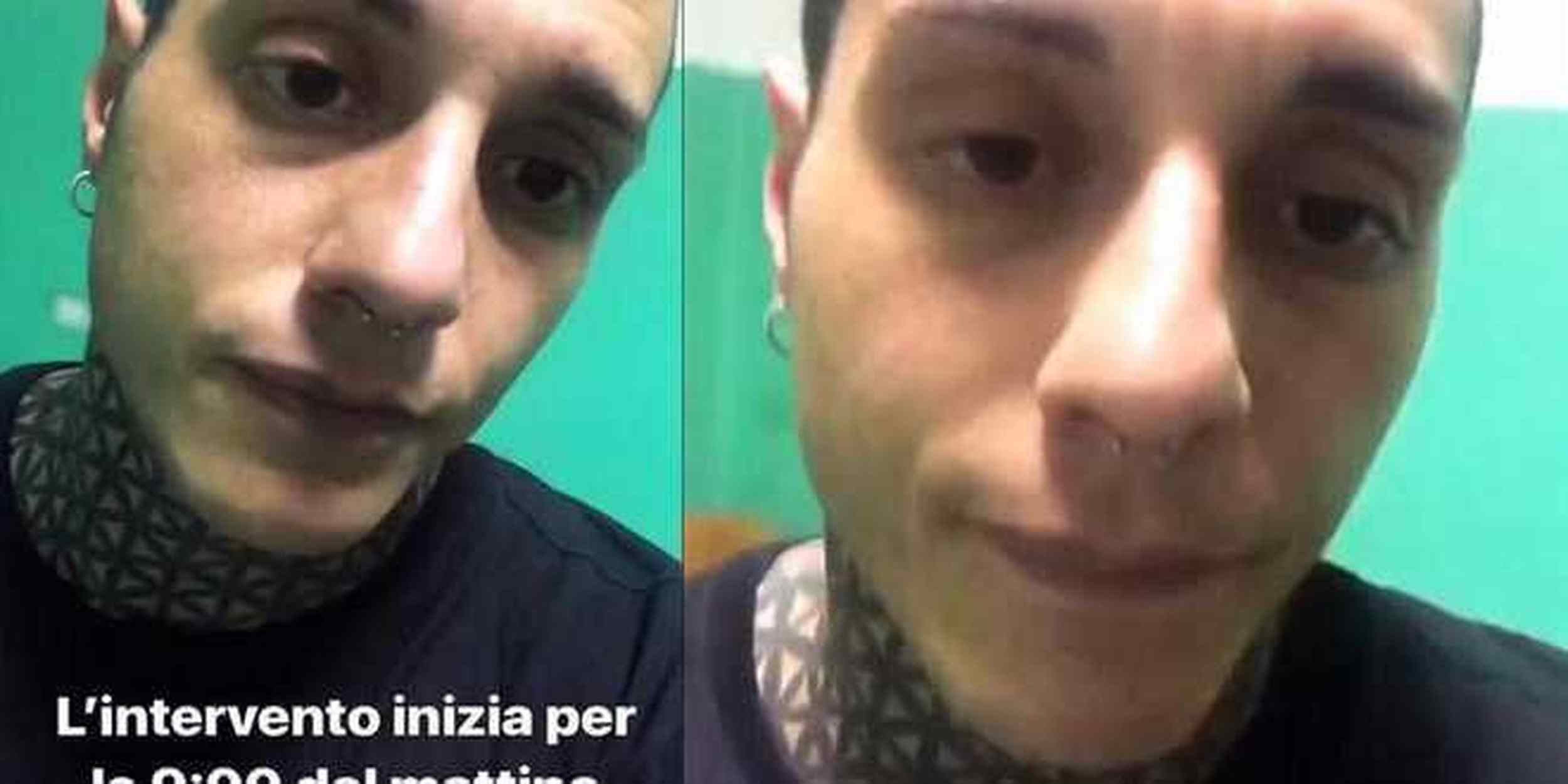 Francesco Chiofalo ha mentito sul tumore? La TAC lo smaschera