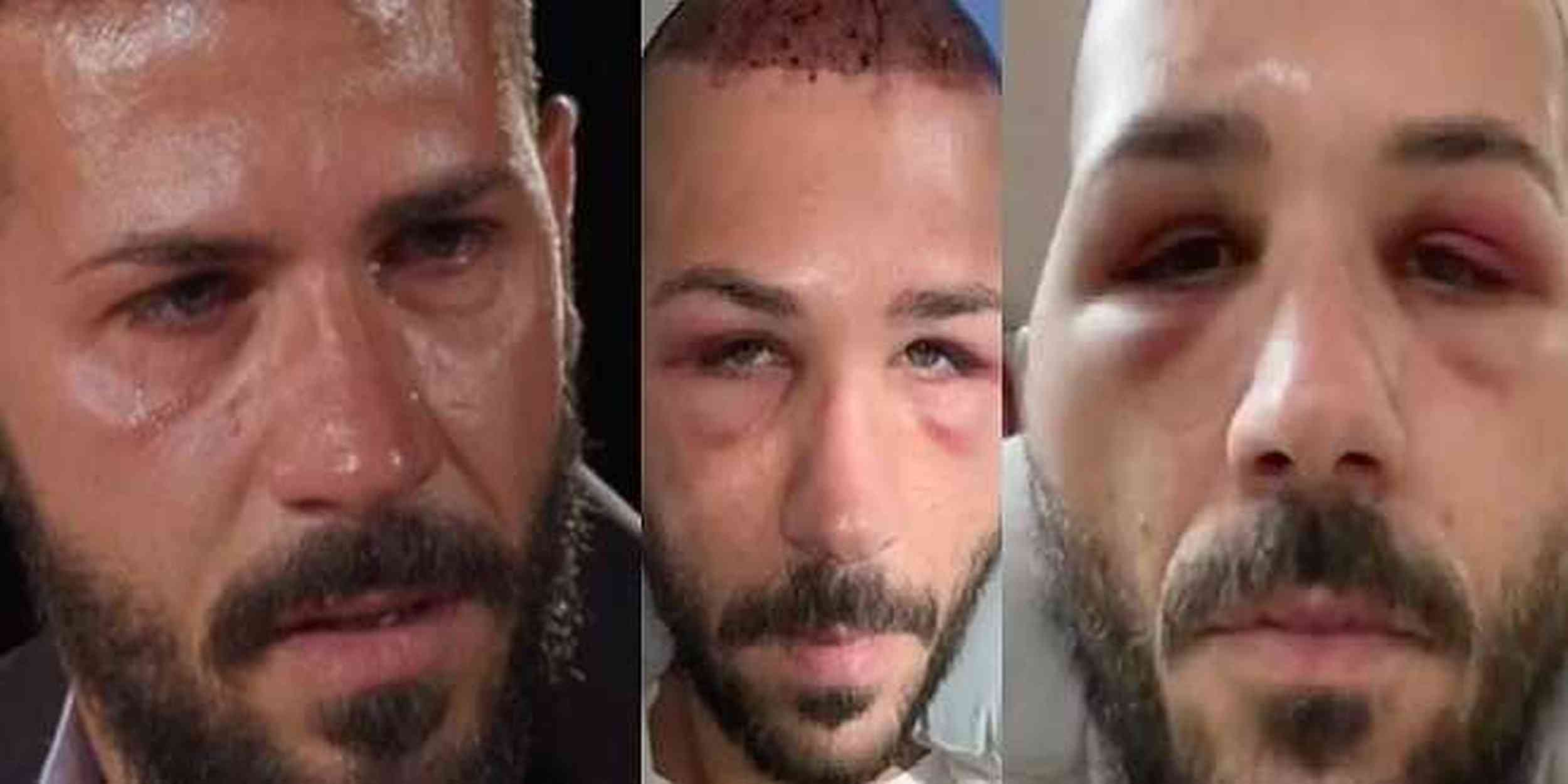 Temptation Island, Federico Rasa dopo il caos in ospedale: “Lasciato solo e peggioravo”