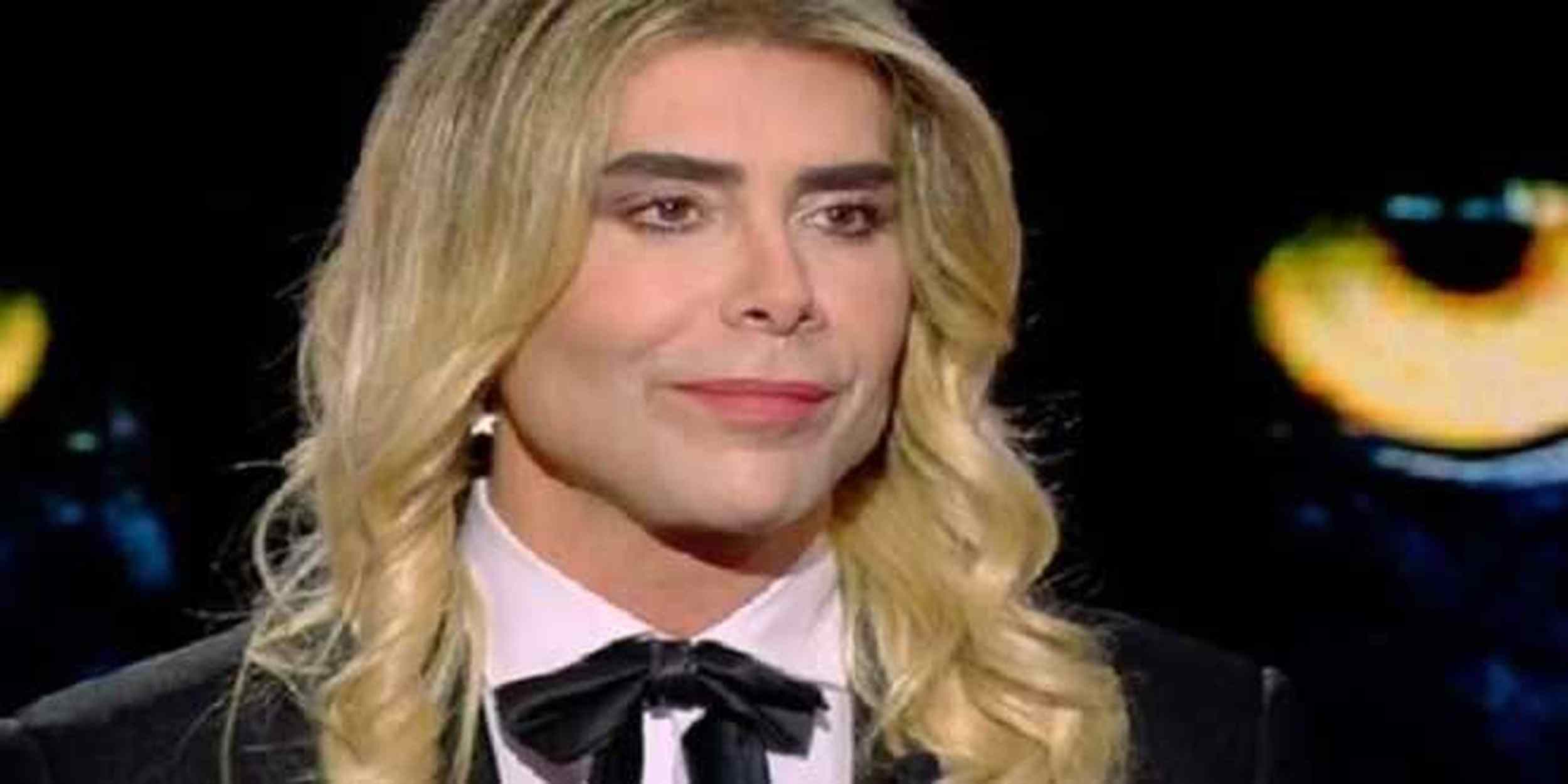 GF Vip, Giacomo Urtis finisce nei guai, l'accusa di una paziente: "Mi ha deformato il viso"