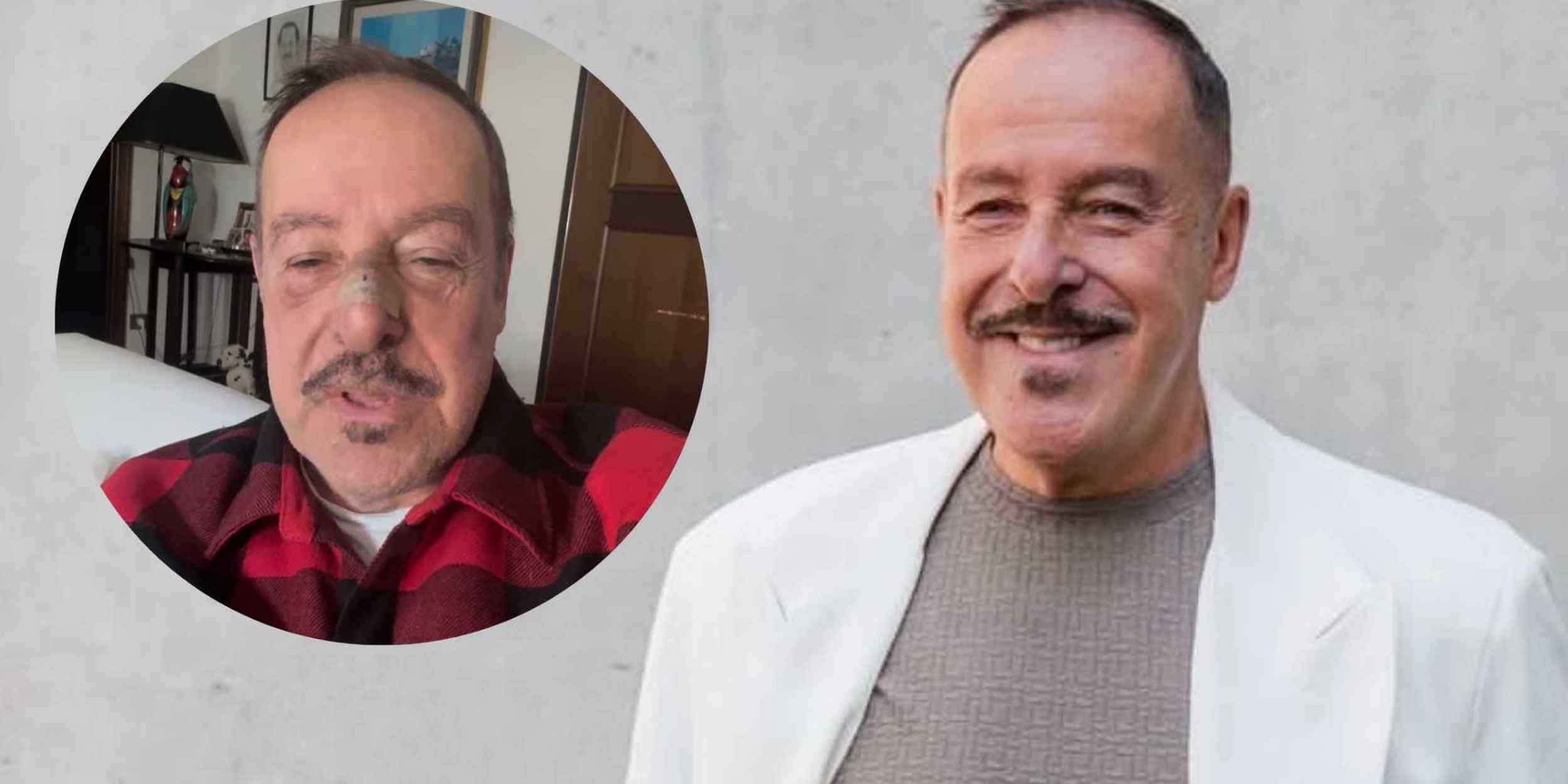 Massimo Lopez investito: il comico racconta l’incidente