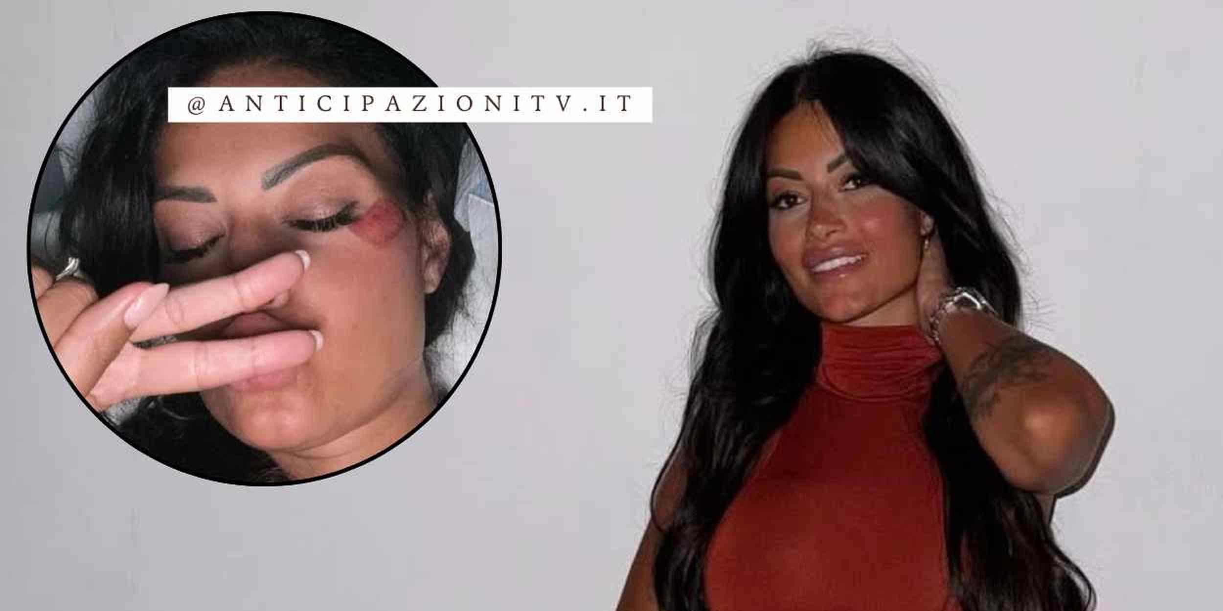 Temptation Island, grave incidente stradale per Alessia Pascarella: ecco come sta