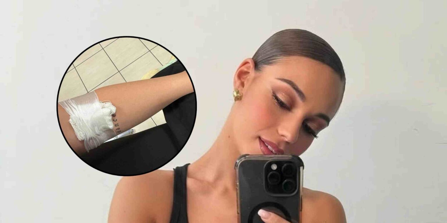 Alessia Pecchia mostra una medicazione al braccio e rassicura i fan su Instagram.