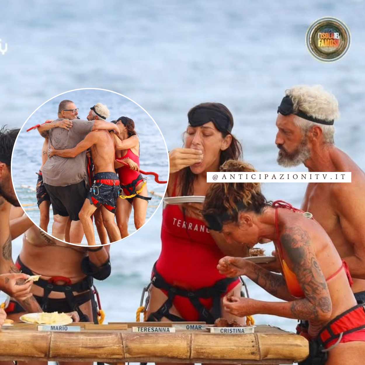 Rosa Perrotta mostra la ferita alla gamba in una story Instagram