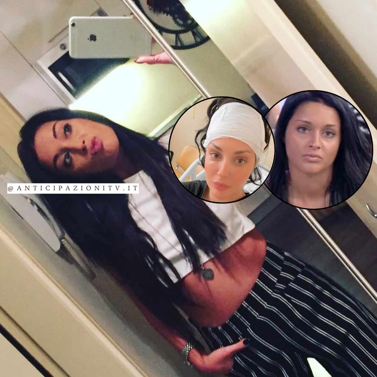 Diletta Pagliano selfie con testa fasciata in ospedale