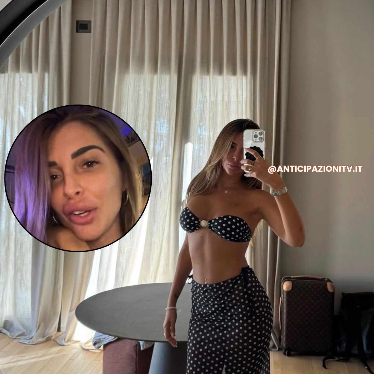 Greta Rossetti mostra le sue labbra naturali dopo la rimozione del filler: un messaggio di consapevolezza