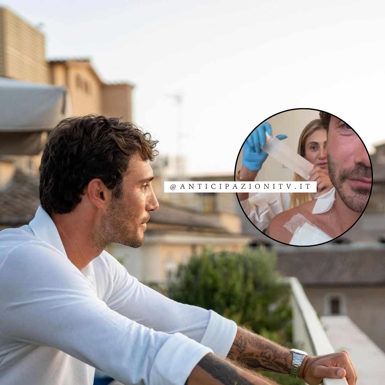 Stefano De Martino prima e dopo la rimozione dei tatuaggi