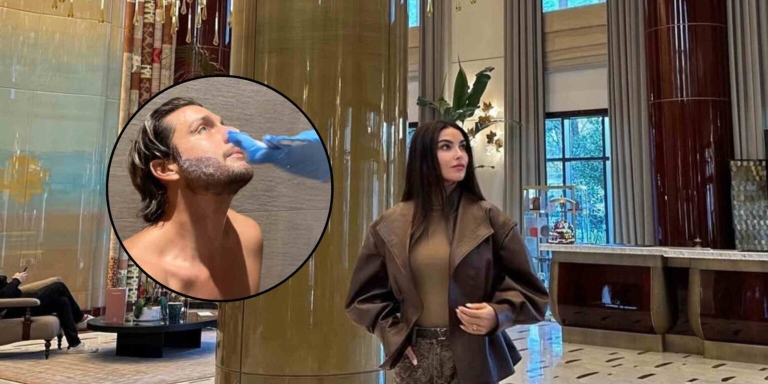 Teresa Langella spiega l’autotrapianto di barba di Andrea Dal Corso e risponde alle critiche sui social.