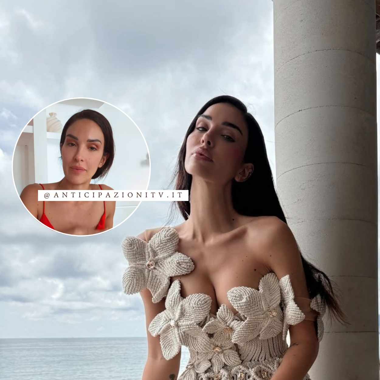 Rosa Perrotta mostra la ferita alla gamba in una story Instagram