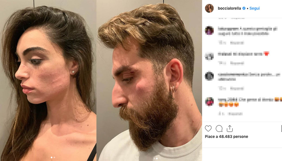 Amici, la ballerina Lorella Boccia e il marito picchiati e derubati: la drammatica testimonianza