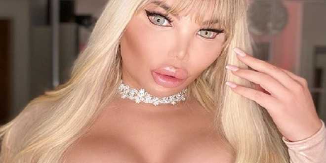 Il Ken Umano è diventato donna: conclusa anche l'ultima operazione