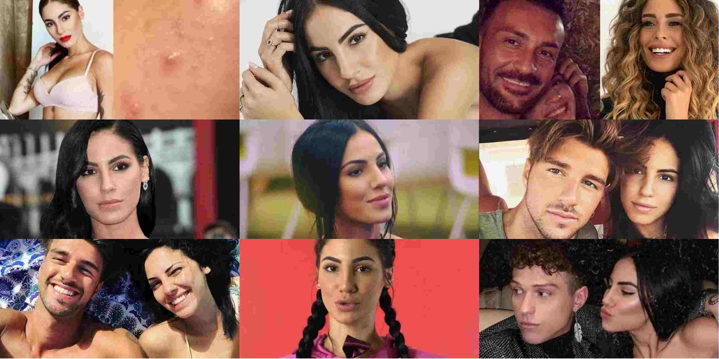 Gossip Uomini e Donne: Giulia De Lellis disperata per l’acne: “Ogni cura fallisce”