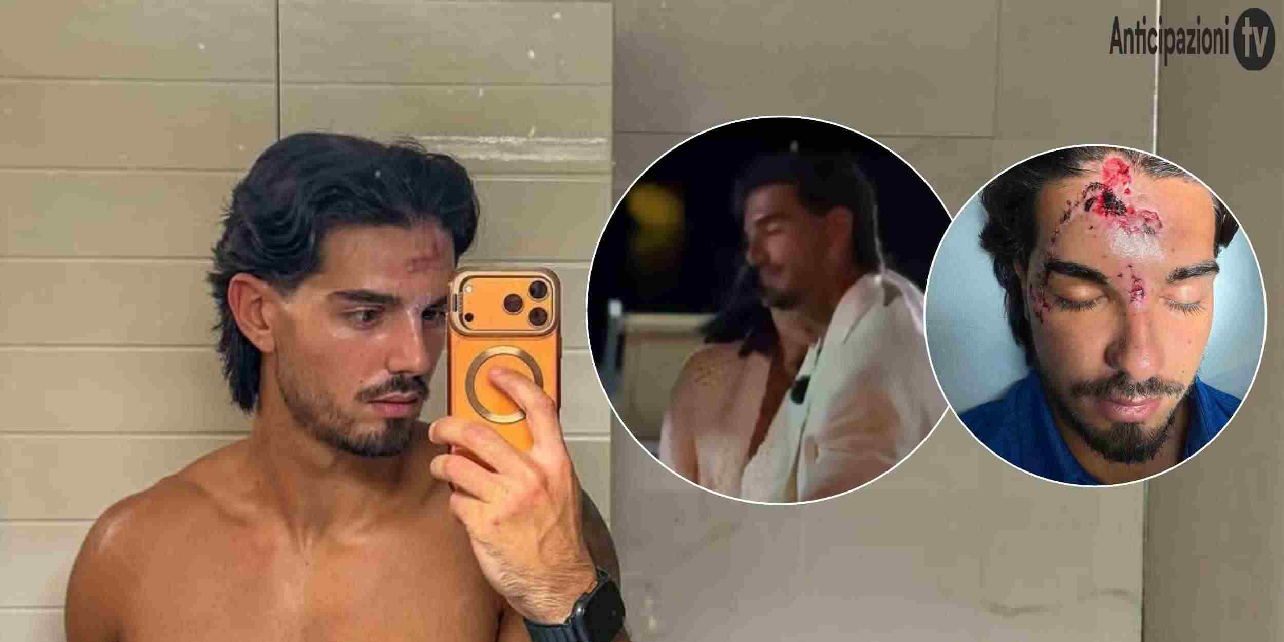 Temptation Island 2026, grave incidente per Marco Fatata: come sta e prime parole del tentatore